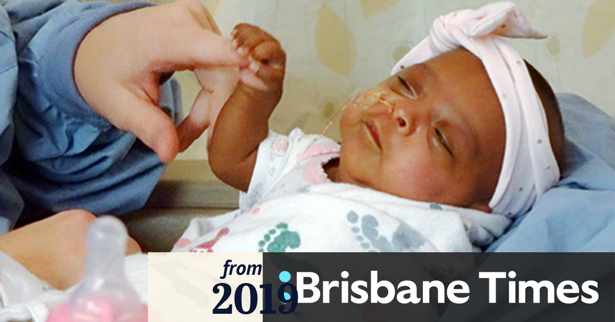 World's smallest baby Saybie at 245 grams 'a miracle'